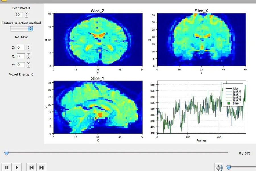 Brain sonification software showing fMRI slices, a three-dimensional brain view and a signal plot