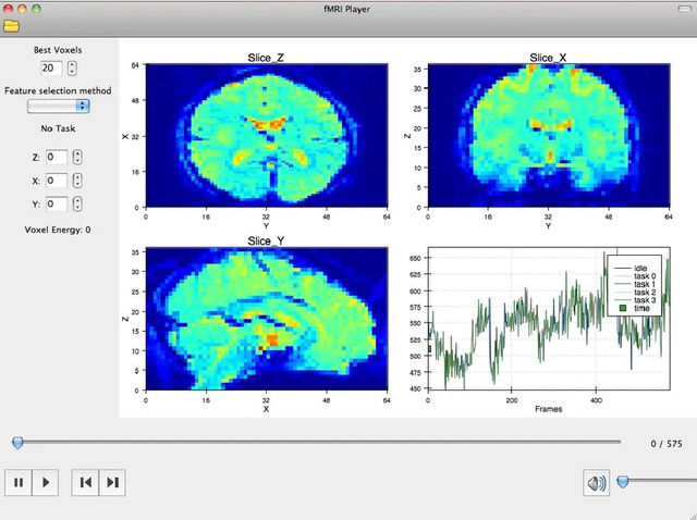 Brain sonification software showing fMRI slices, a three-dimensional brain view and a signal plot